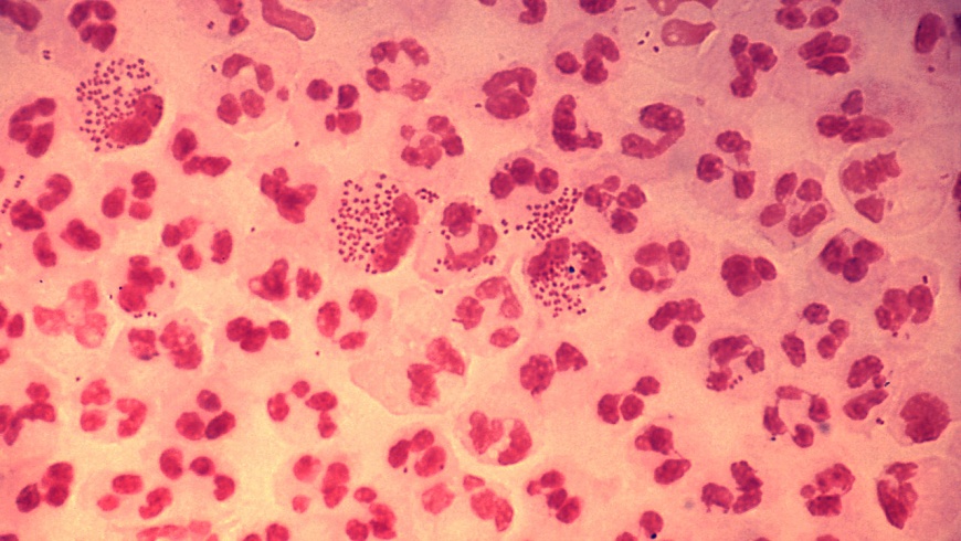 Neisseria gonorrhoeae